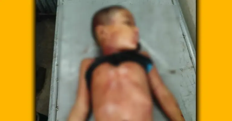 ইজিবাইকের ধাক্কায় নিহত শিশু